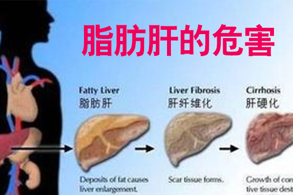 脂肪肝發展變化過程