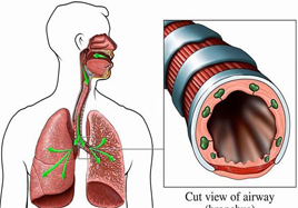 寒冬支氣管炎的高發期 補硒安全過冬