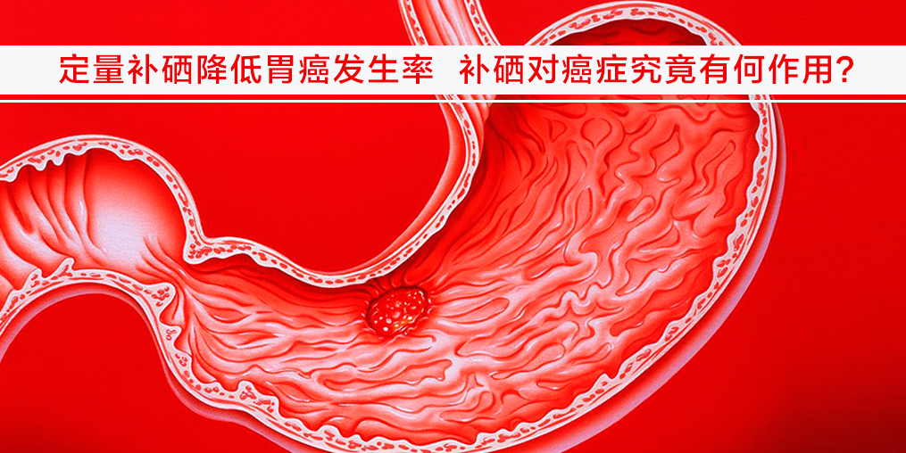 遠離胃癌不難，改變不良習慣外多補硒