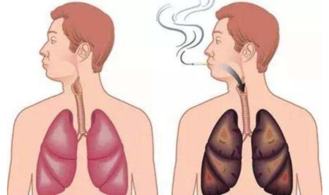 補硒，給你的肺部洗洗澡吧