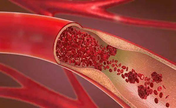 長期服用他汀類患者為什么要補充輔酶Q10？