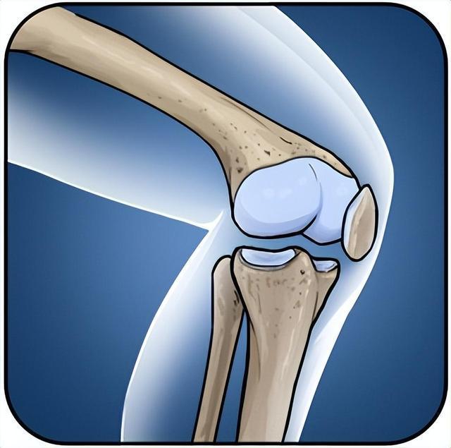 氨糖軟骨素與關節軟骨的關系，可惜很多人不知道